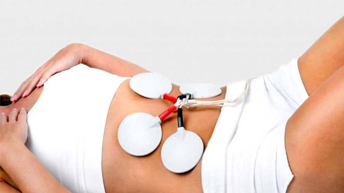 Elektro Stimülasyon